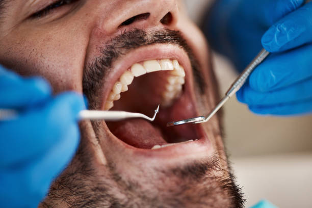Best Broken or Cracked Tooth Emergency Dentist in Dormont, PA
